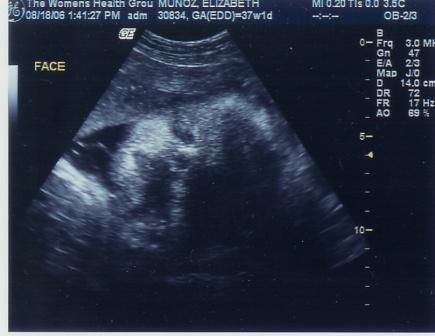 Can't Wait To Meet You!