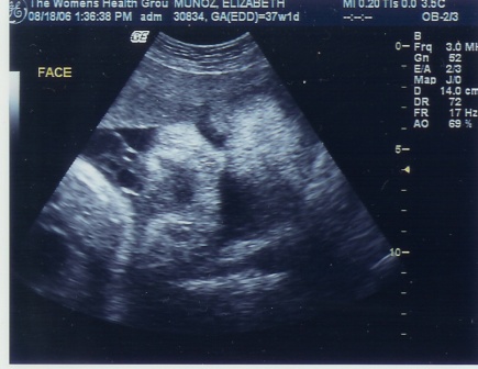 Next time you see me it will be in color :)