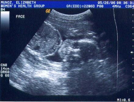 Just me saying Hi again