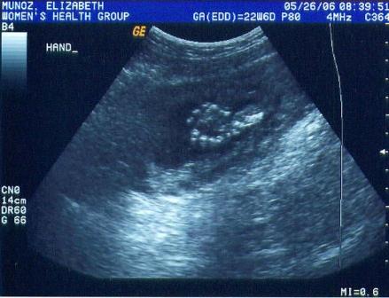 This time I will wave!