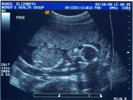 Here is a picture of my face