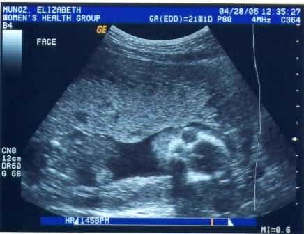 Another picture of my face