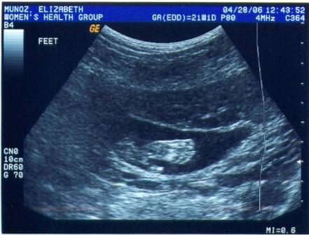 A picture of my feet